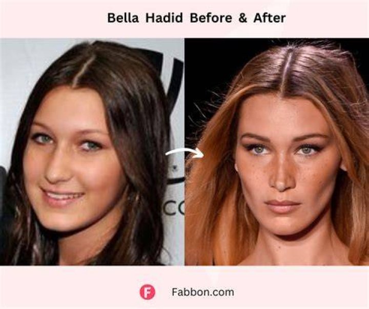 Bella Hadid Discusses Losing Weight