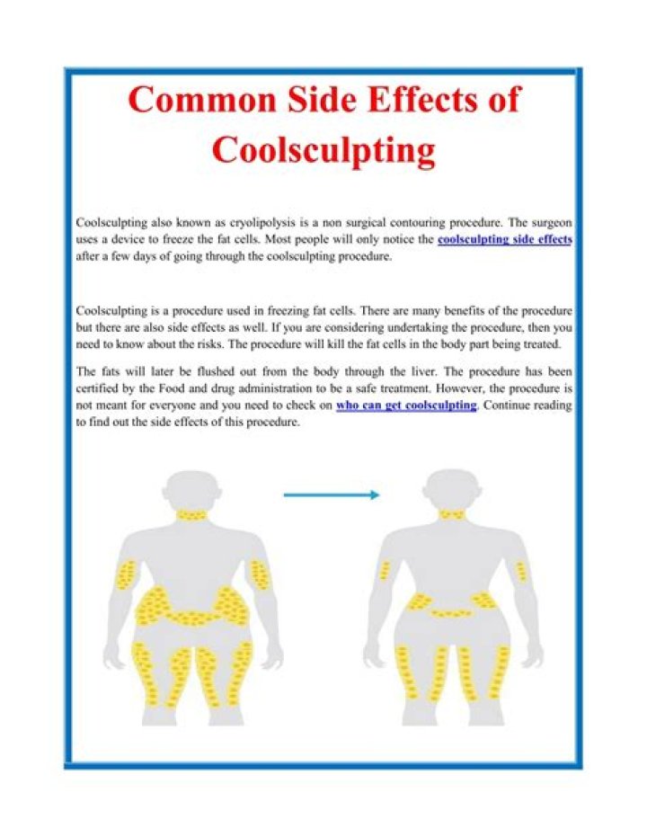 CoolSculpting Side Effects What Happened to Linda Evangelista