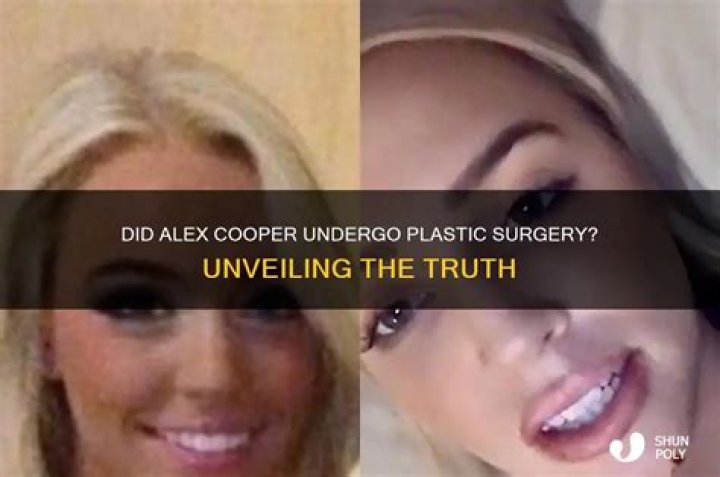 Did Alex Cooper Get Plastic Surgery? Photos Then and Now