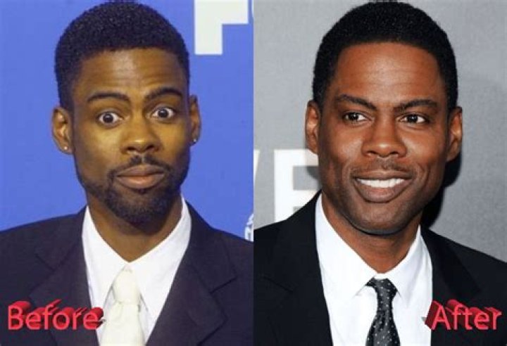 Has Chris Rock Had Plastic Surgery? Or Is It Just His Genes?