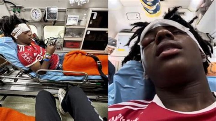 IShowSpeed eye injury update American YouTuber goes for Surgery after