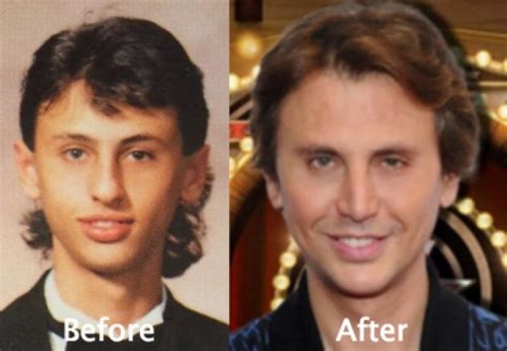 Jonathan Cheban Plastic Surgery Before And After Face Photos 2018
