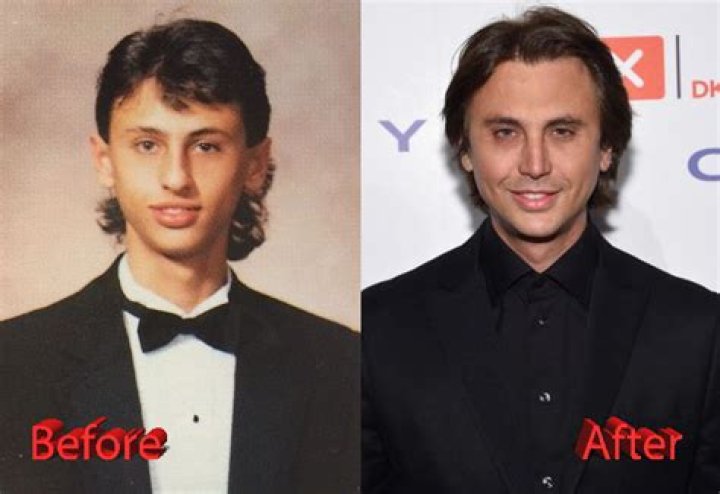 Jonathan Cheban Plastic Surgery You Be The Judge