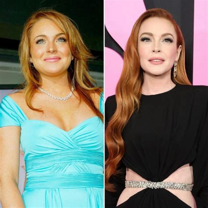 Lindsay Lohan It's hard to believe she's only 25. Plastic surgery