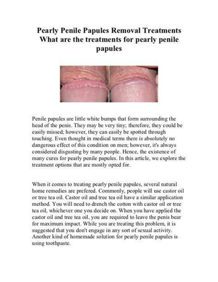 Pearly Penile Papules Reason