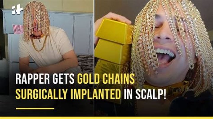 Rapper Dan Sur Gets Gold Chain Implanted Into His Head &mdash; Guardian Life