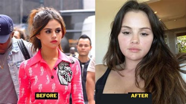 Selena Gomez talks weight gain due to medication ABC News