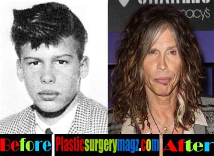 Steven Tyler Before Plastic Surgery