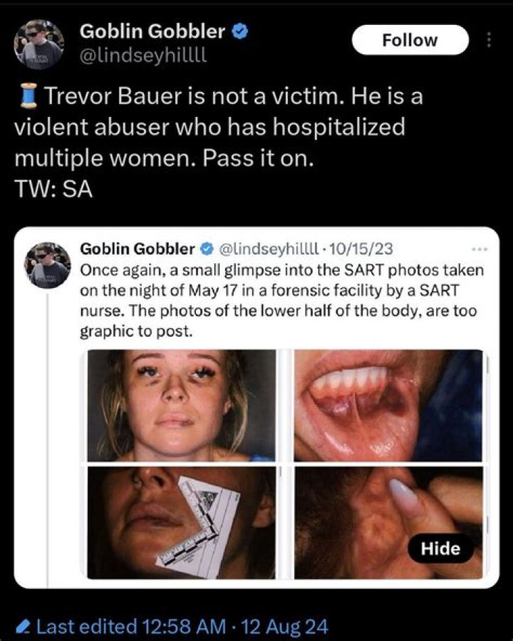 Trevor Bauer Sexual Assault Everything We Know