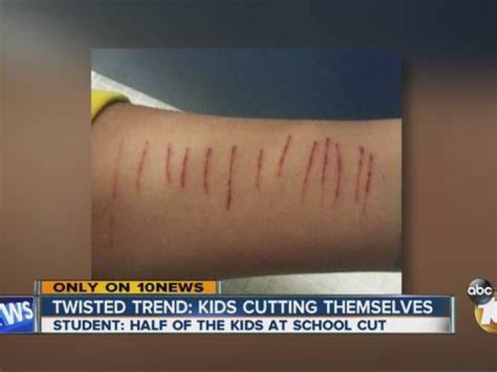 Twisted trend Kids cutting themselves