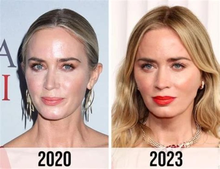 What Plastic Surgery Has Emily Swallow Gotten? Body Measurements and